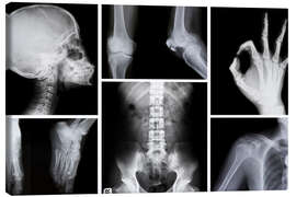 Leinwandbild  Röntgenbilder des menschlichen Körpers